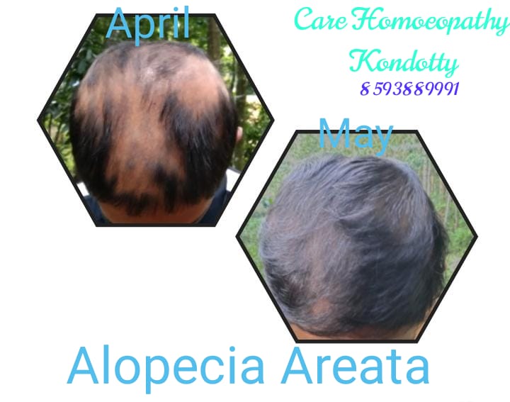 Care Homoeopathy Kondotty