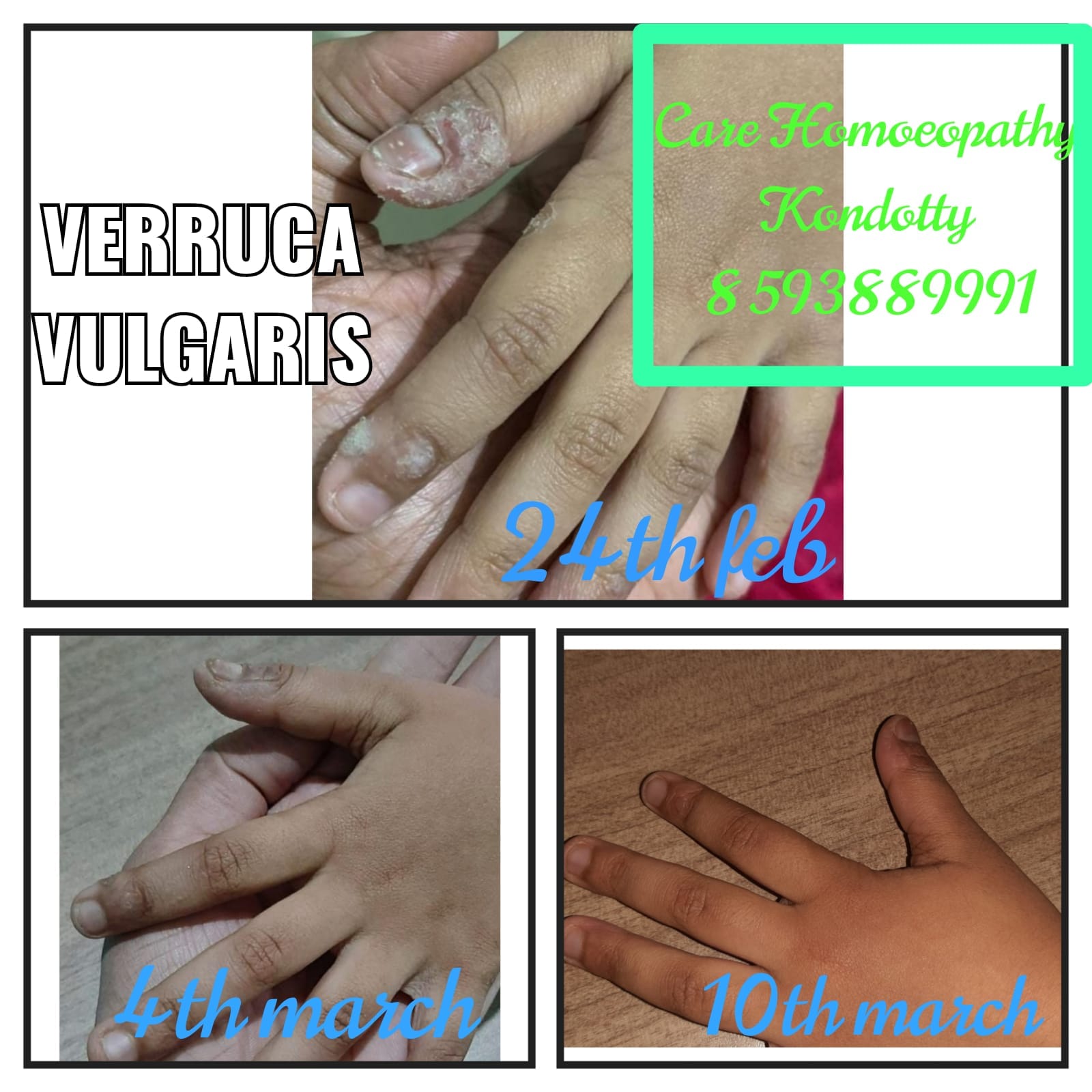 Care Homoeopathy Kondotty