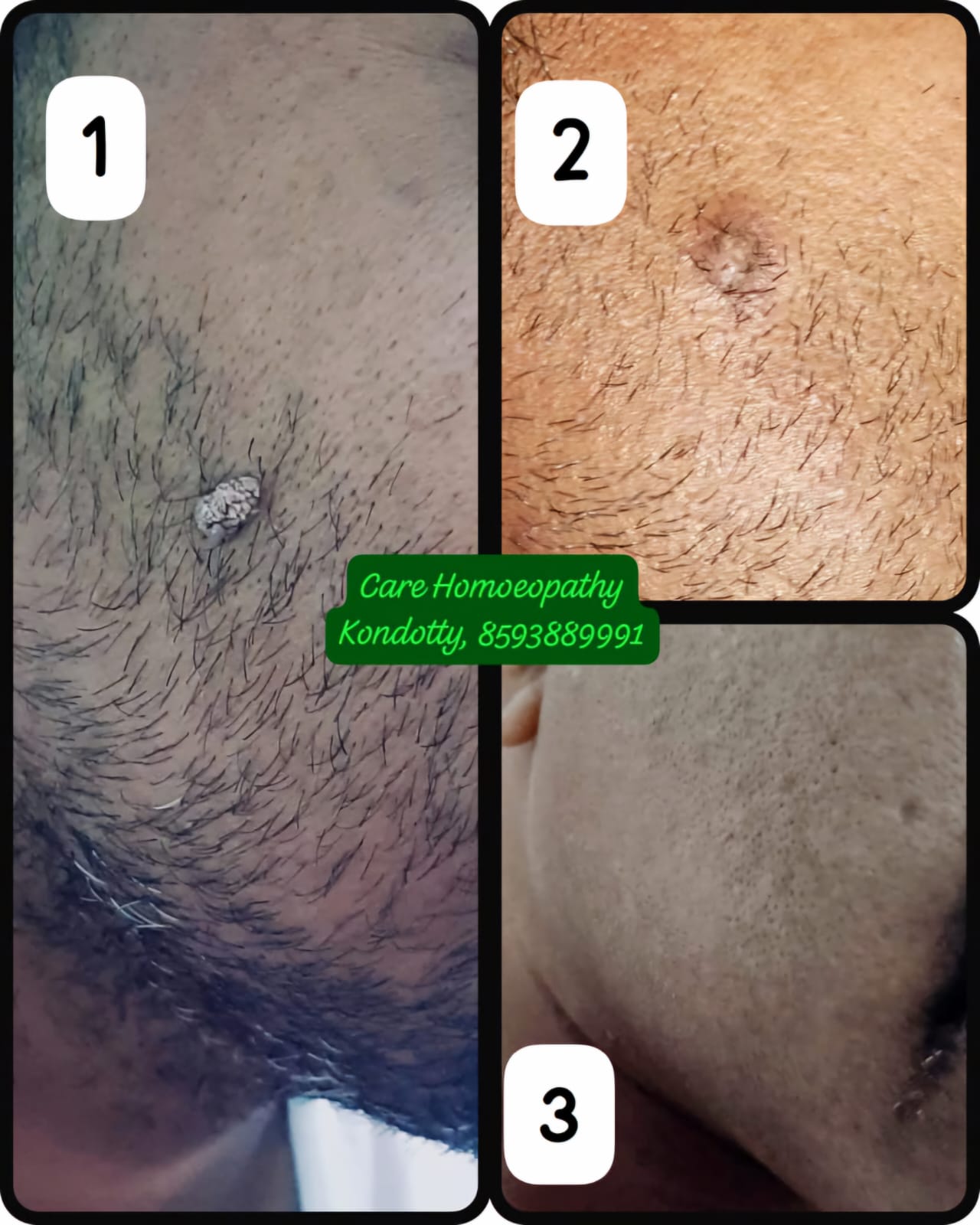 Care Homoeopathy Kondotty