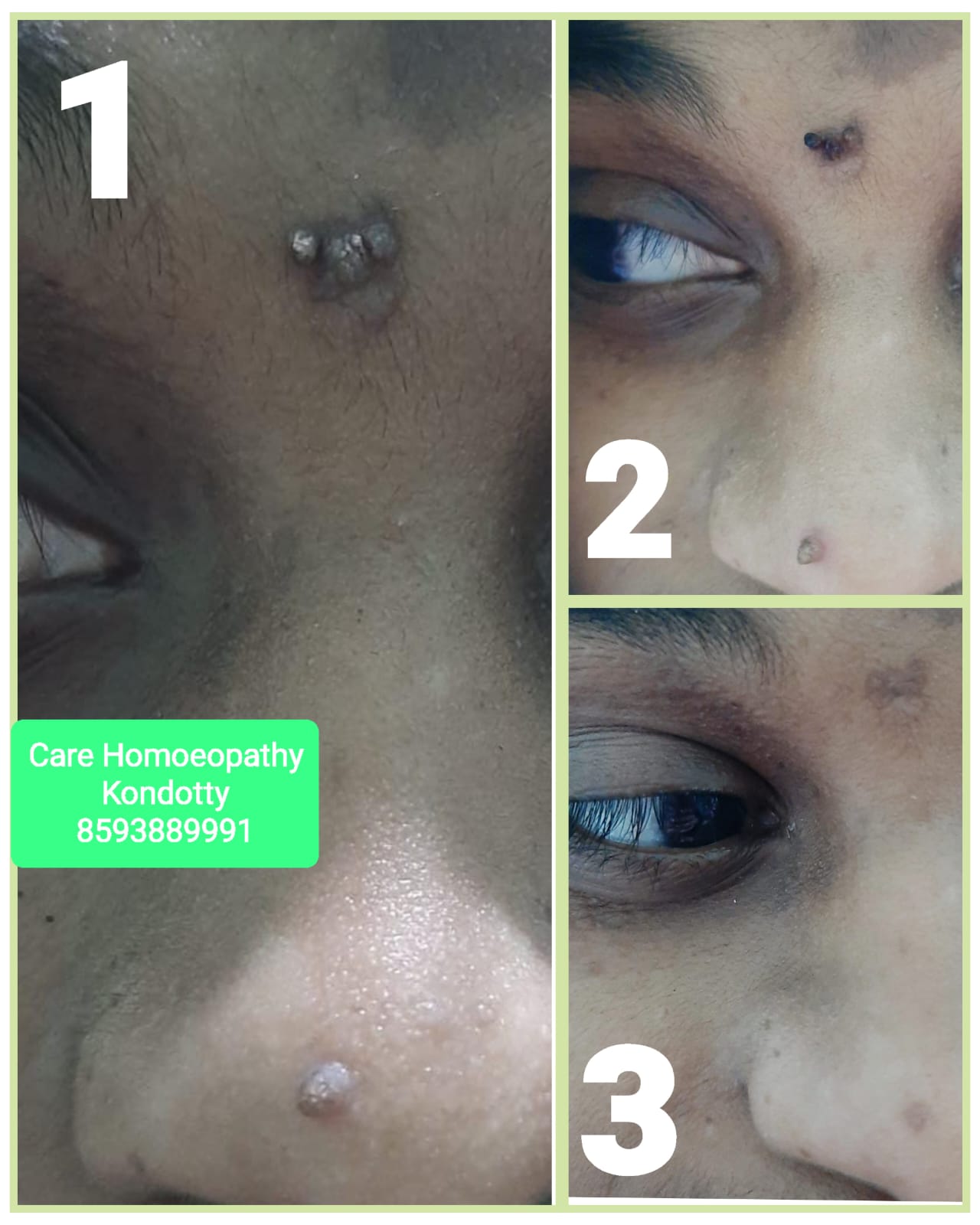 Care Homoeopathy Kondotty